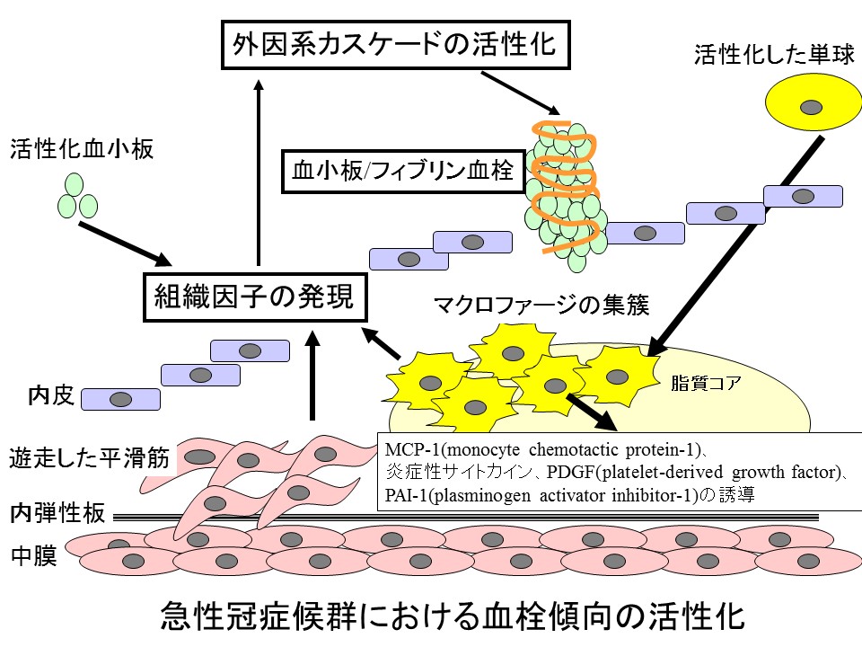 冠 症候群 急性